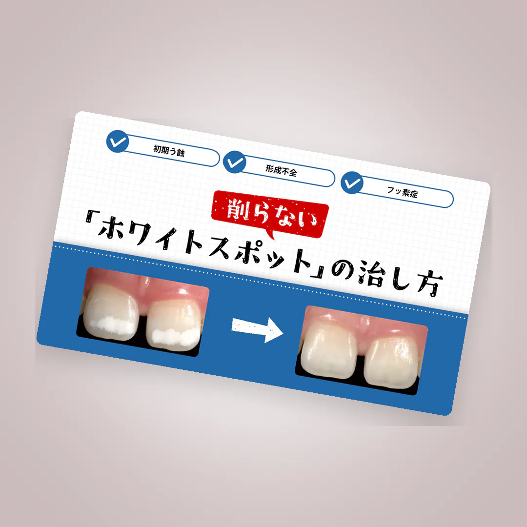 インプラント・パーシャルデンチャーの基礎と臨床｜歯科オンライン