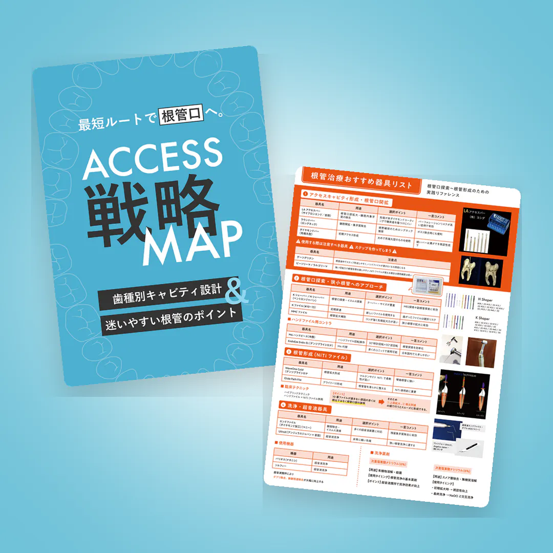 全5回】歯内療法マスタークラス第3回。よくあるエンドの悩みを、理論的