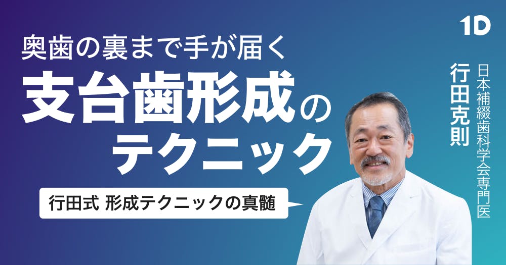 テーパー過剰を回避する、支台歯形成のテクニック｜歯科オンライン