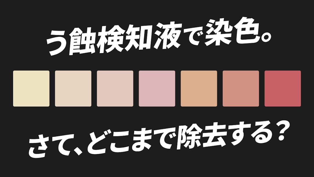 自費を高めるCR充填のすべて