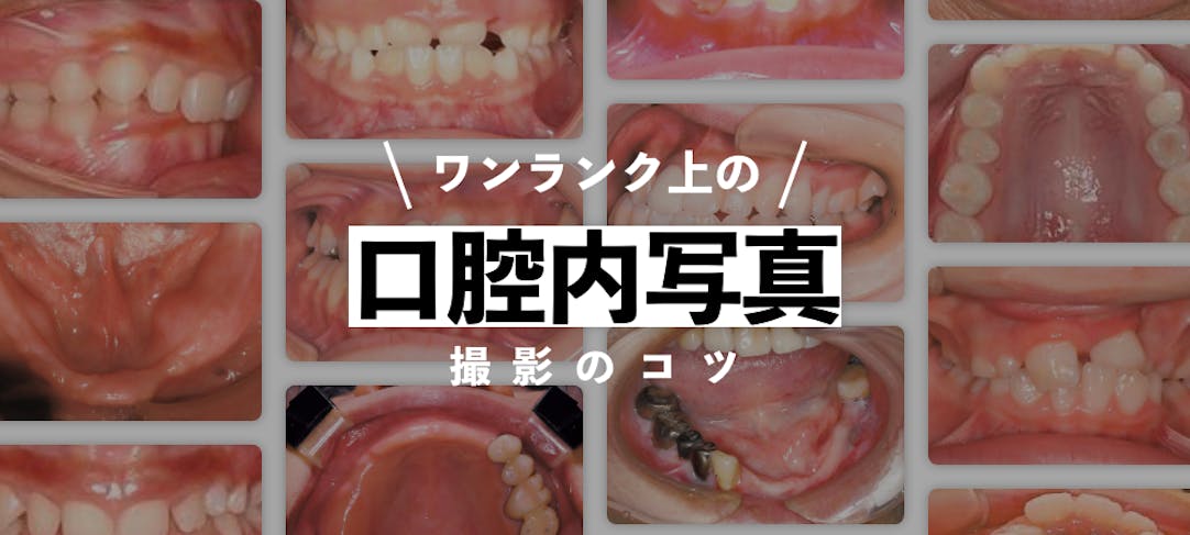 歯科衛生士さんのための口腔内撮影術