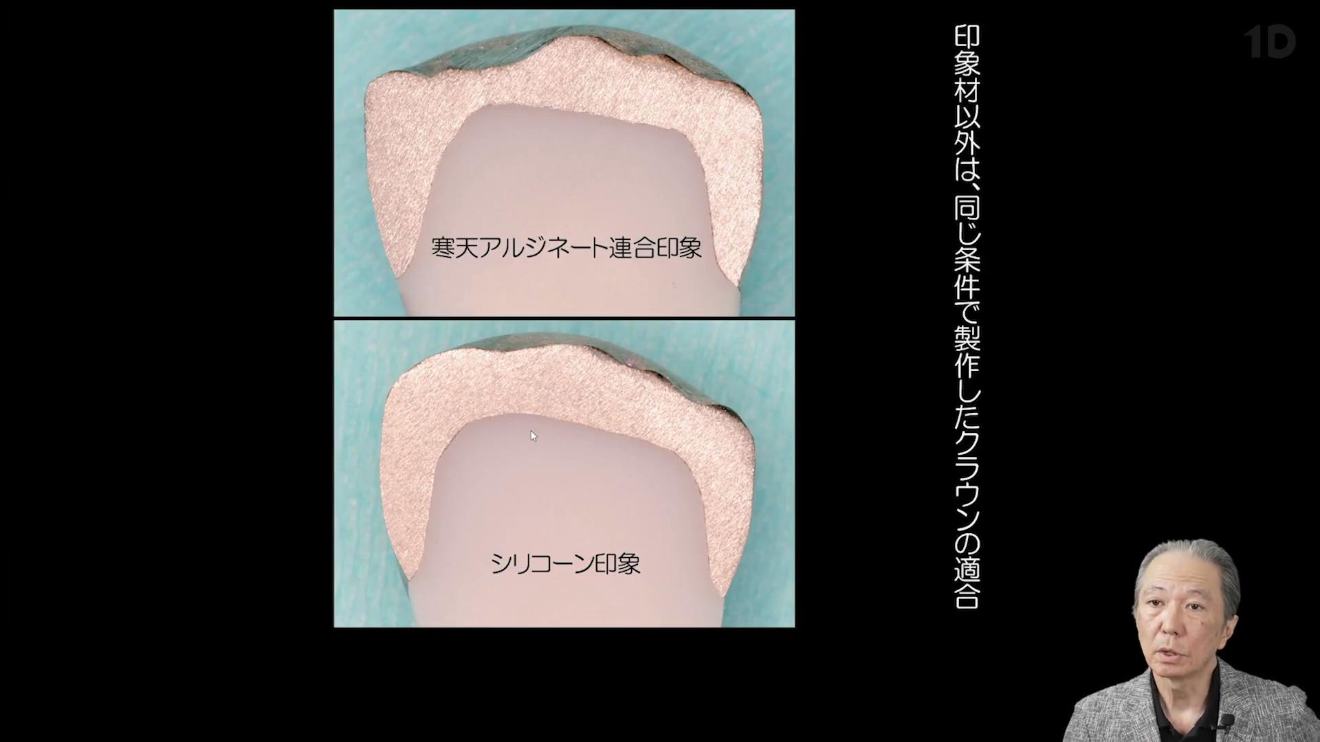 寒天アルジネート連合印象」の勘所・コツ。高精度&低コストを
