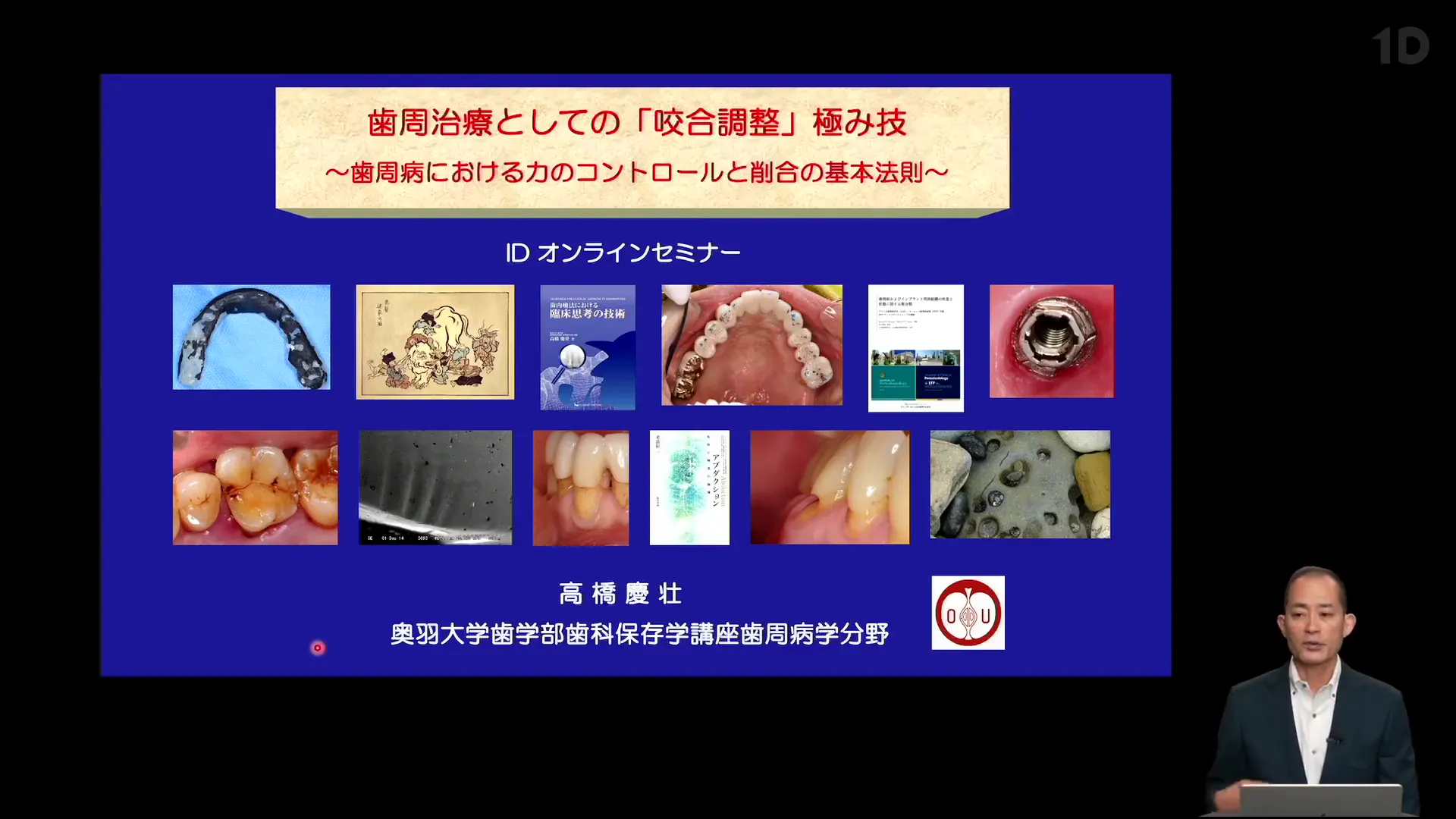 歯周治療としての「咬合調整」極み技｜歯科オンラインセミナー・録画