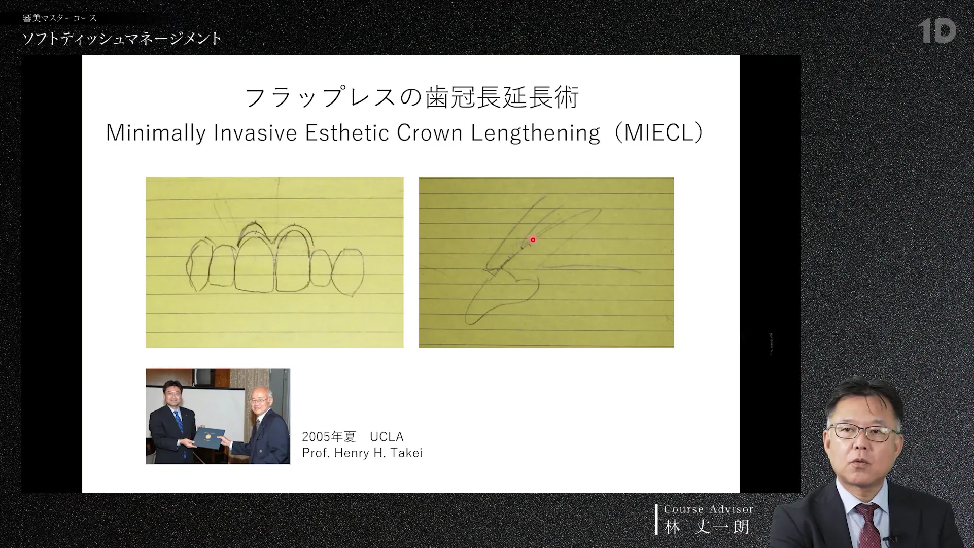 ソフトティッシュマネージメント｜歯科オンラインセミナー・録画配信は