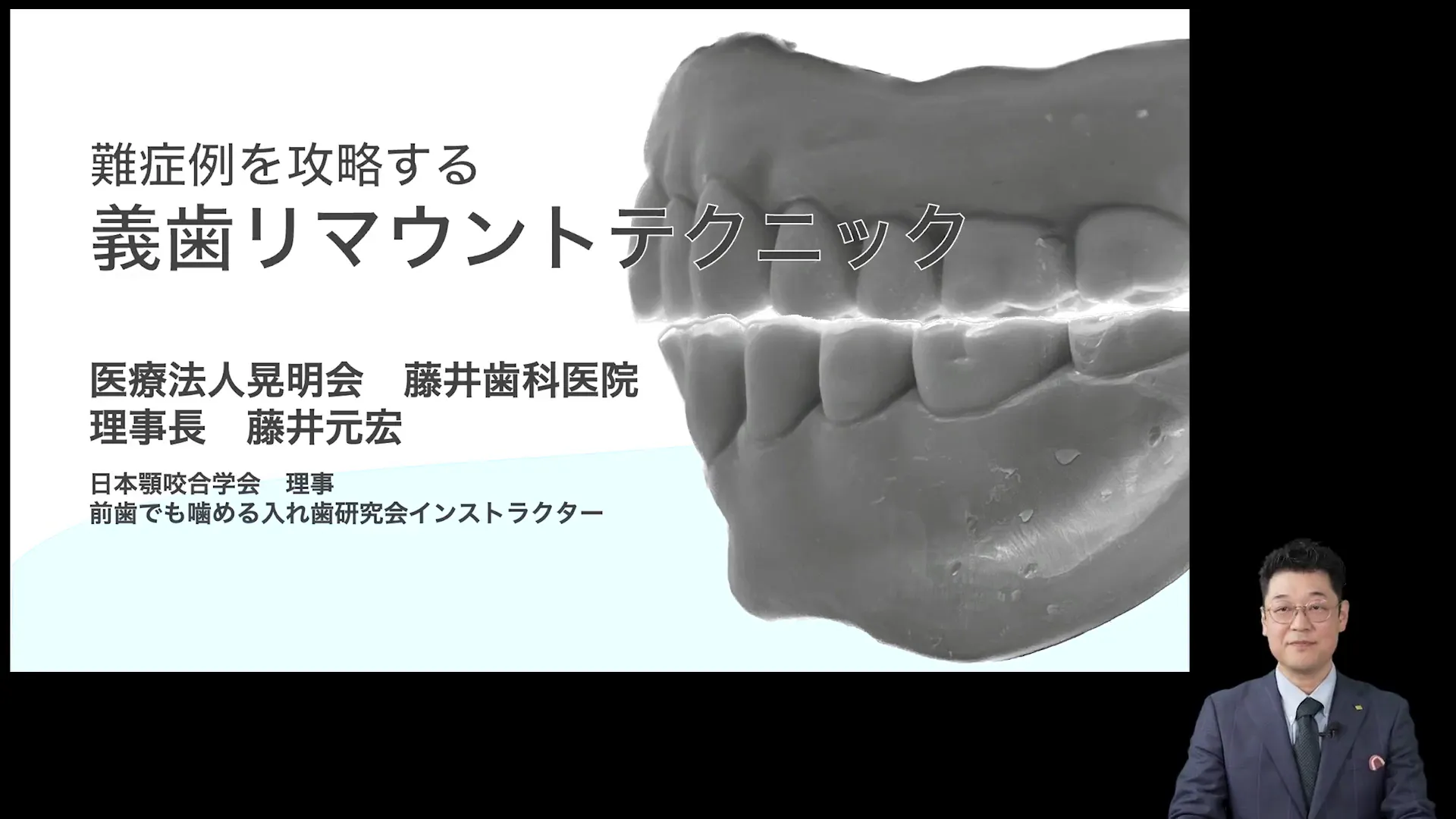 難症例を攻略する「義歯リマウントテクニック」。しっかり噛める義歯の