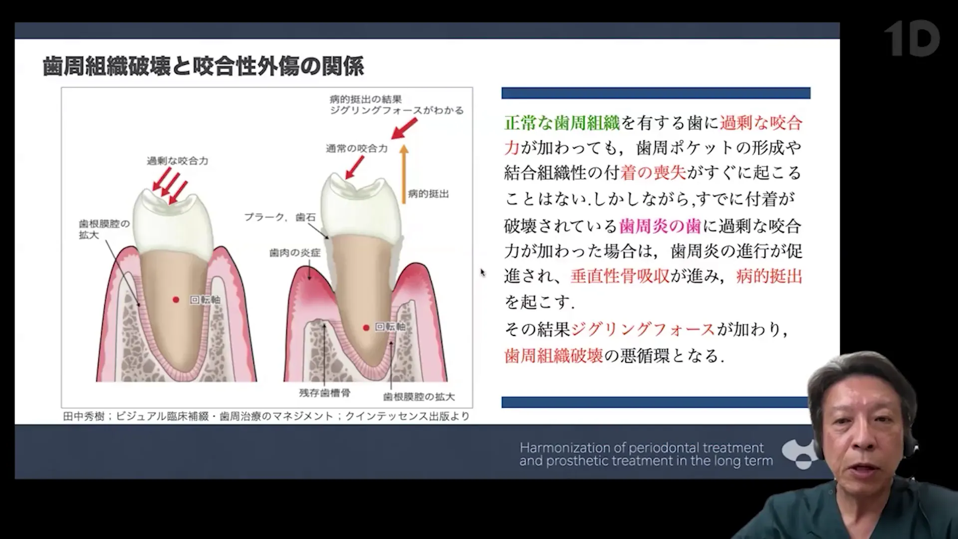 症例で学ぶ「歯周・補綴治療」の理論と実際｜歯科オンラインセミナー