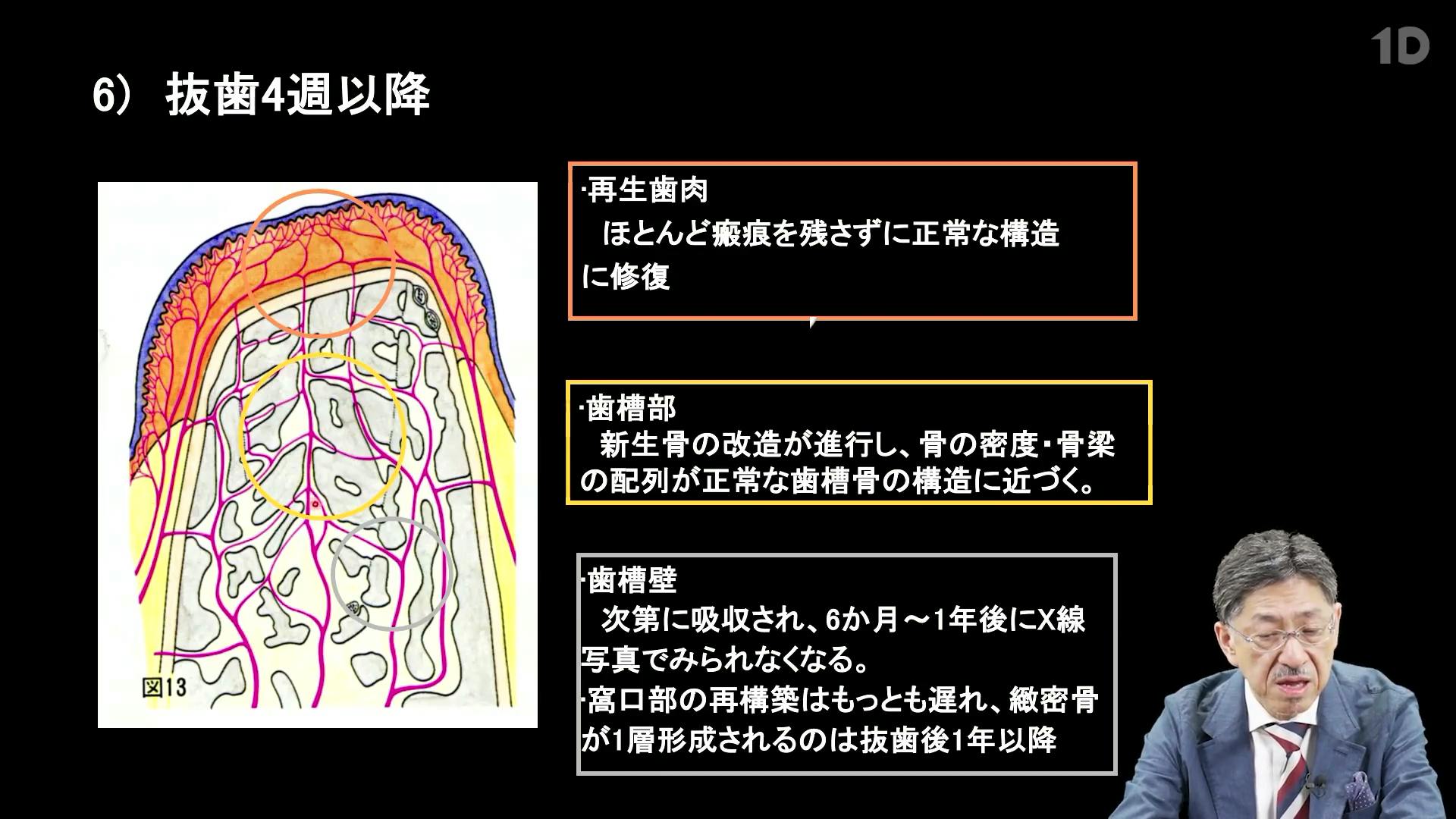 ソケットプリザベーション 詳解「ソケットプリザベーション」｜歯科オンラインセミナー