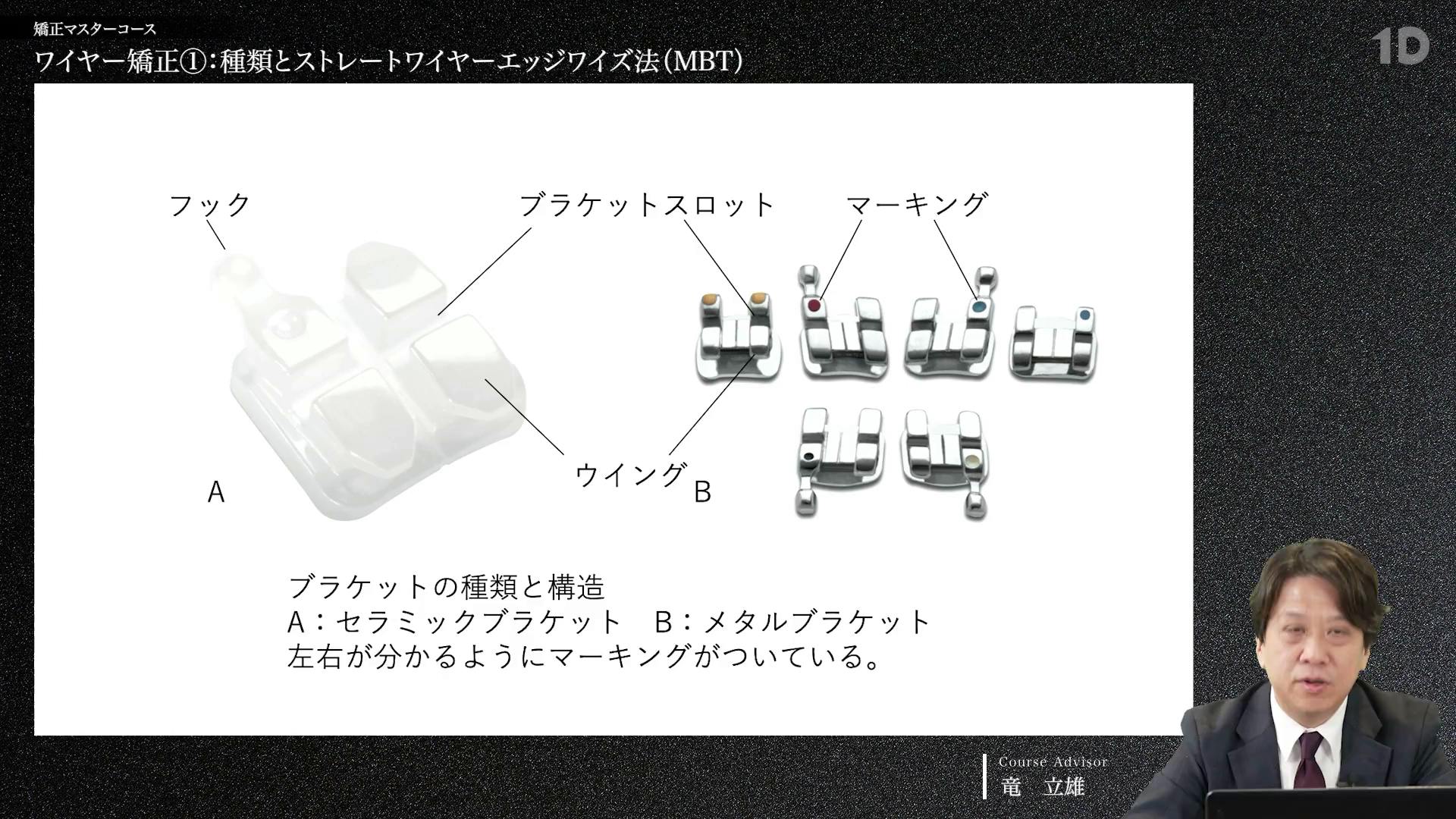 ワイヤー矯正①：種類とストレートワイヤーエッジワイズ法（MBT