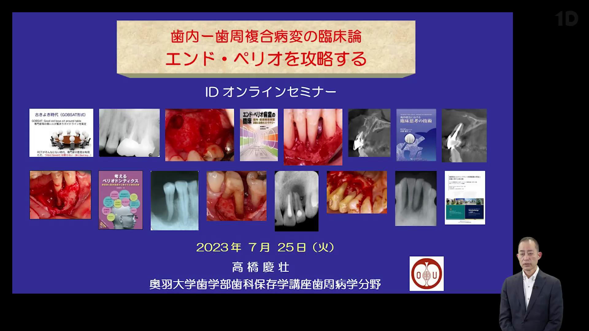 エンド-ペリオ」は、こう考える。歯内歯周複合病変の鑑別診断と実践