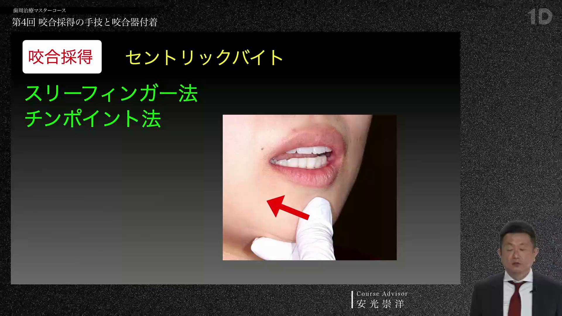 咬合採得の手技と咬合器付着｜歯科オンラインセミナー・録画配信は1D