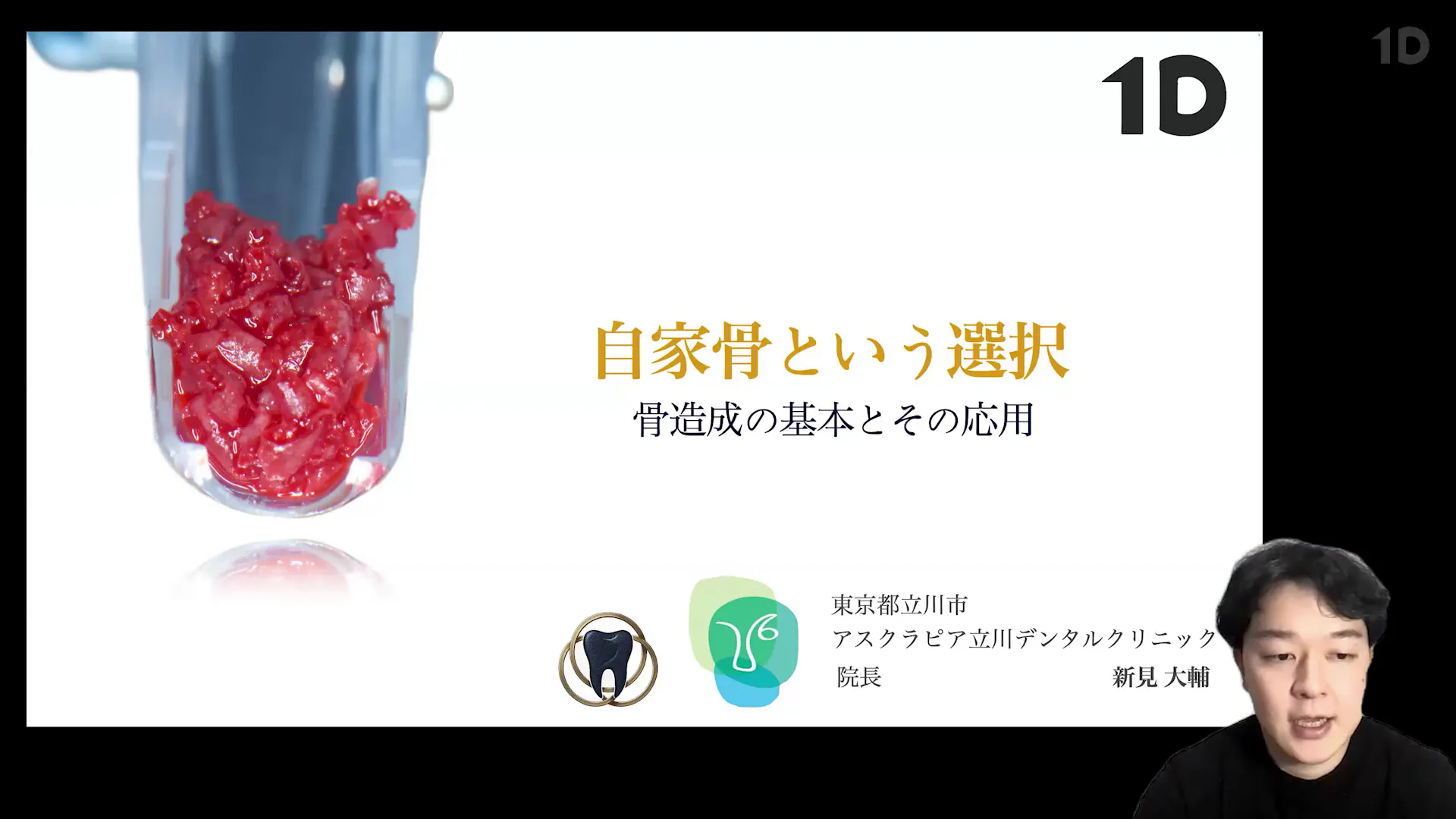 自家骨移植の臨床論｜歯科オンラインセミナー・録画配信は1D（ワンディー）