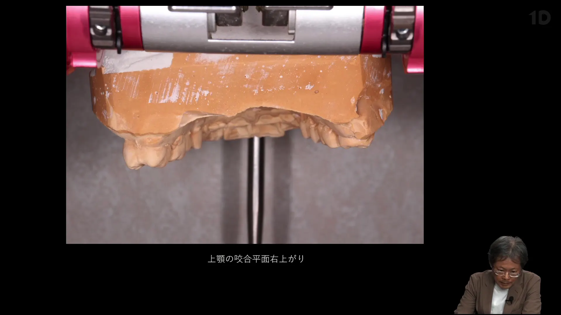 咬合オタク”の咬合調整｜歯科オンラインセミナー・録画配信は1D