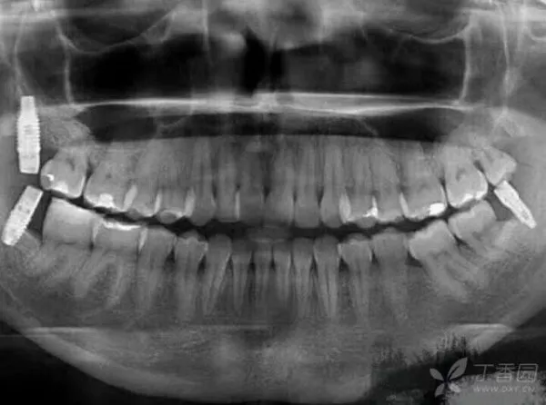 ツイッターでの拾い物ですが 歯科医療とは Yasunori Sさんの投稿 歯科医師 衛生士 技工士向けsns 情報サイト1d ワンディー