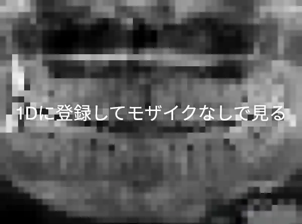 ツイッターでの拾い物ですが 歯科医療とは Yasunori Sさんの投稿 歯科医師 衛生士 技工士向けsns 情報サイト1d ワンディー ツイッターでの拾い物ですが 歯科医療とは Yasunori Sさんの投稿 歯科医師 衛生士 技工士向けsns 情報サイト1d ワンディー
