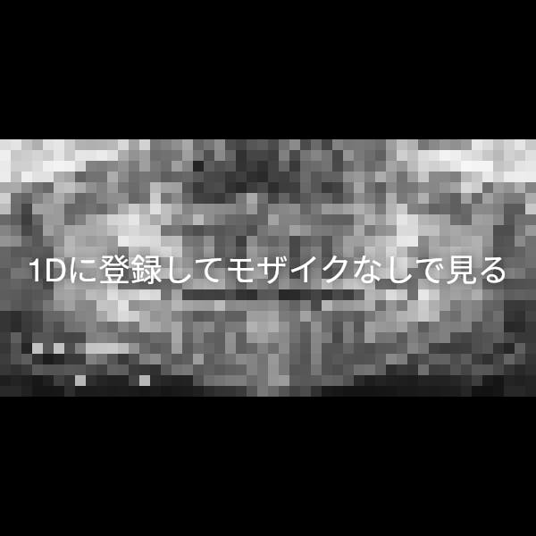下顎骨骨折 1d歯科用語辞典 下顎骨骨折 1d歯科用語辞典
