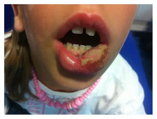 局所麻酔薬 1d歯科用語辞典