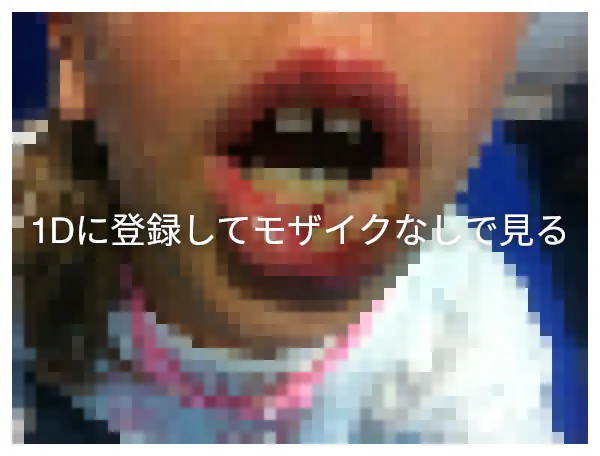 局所麻酔薬 1d歯科用語辞典 局所麻酔薬 1d歯科用語辞典