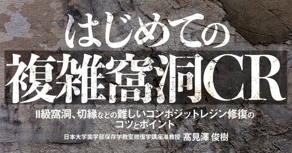 はじめての「咬合採得」｜歯科オンラインセミナー・録画配信は1D