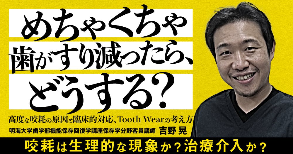 ⚠裁断済み　咬合再構成におけるバーティカルディメンジョン　機能と審美の融合 咬合再構成におけるバーティカルディメンジョン ー機能と審美の
