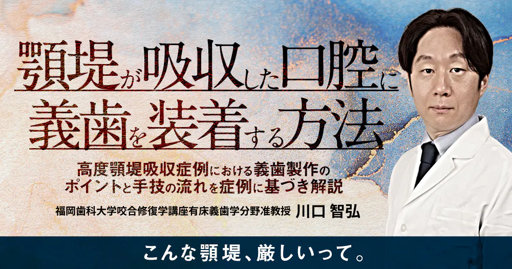 総義歯マスタリー｜歯科オンラインセミナー・録画配信は1D（ワンディー）