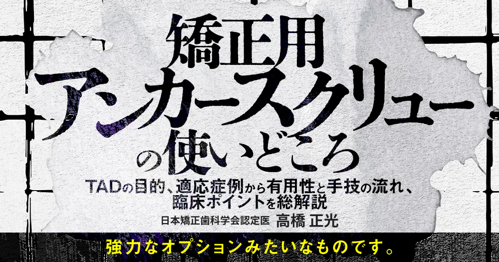 安心・安全歯科矯正用アンカースクリューこの症例にこの方法 症例でわかる歯科矯正用アンカースクリュー活用術 | 後藤 滋巳, 齋藤