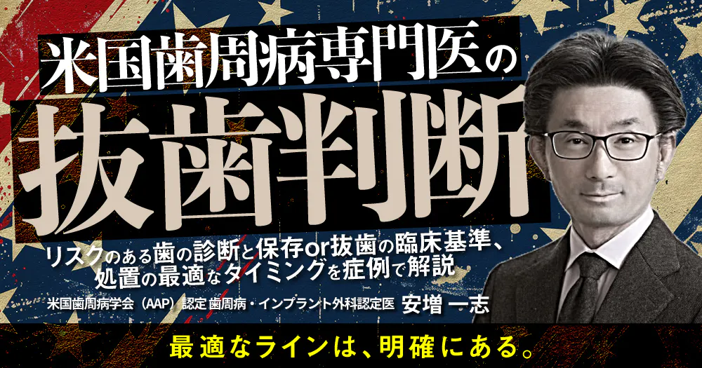 米国歯周病専門医”の抜歯判断｜歯科オンラインセミナー・録画配信は1D