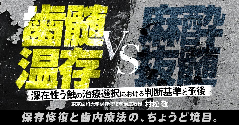 歯に優しいけどムズかしい、接着ブリッジの臨床論。デザイン・形成の