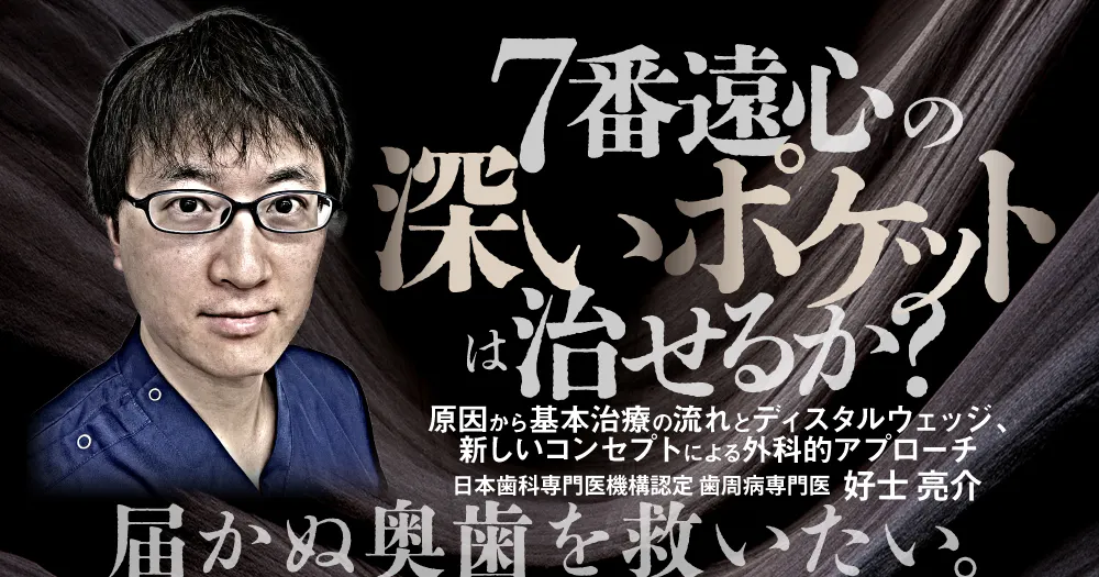 7番遠心の深いポケットは治せるか？｜歯科オンラインセミナー・録画