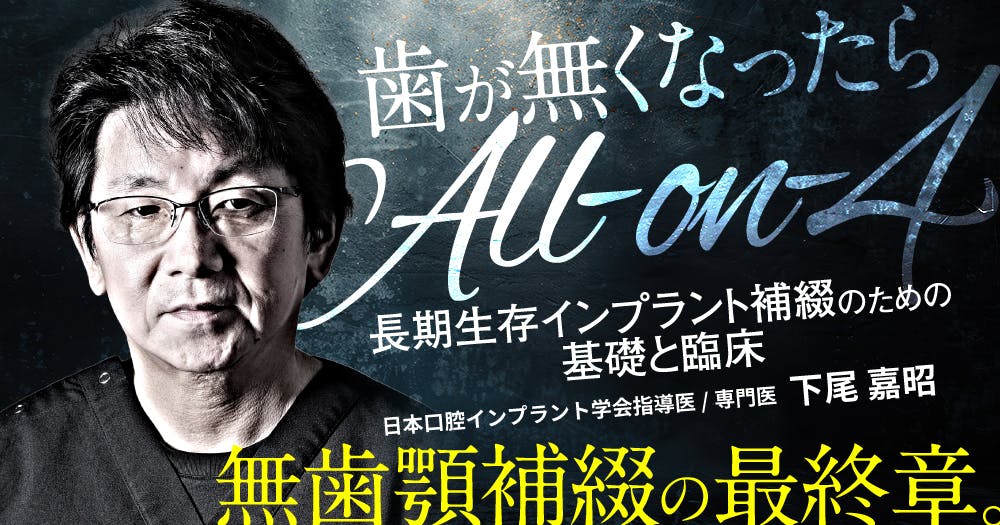 歯が無くなったら「All-on-4」｜歯科オンラインセミナー・録画