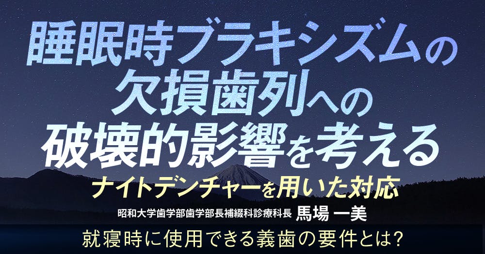 接着ブリッジ講座 歯に優しいけどムズかしい、接着ブリッジの臨床論。デザイン