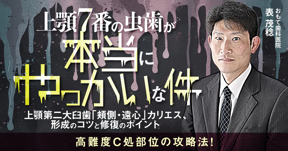 歯科　【裁断済み】　必ず上達CR修復 必ず上達 CR(コンポジットレジン)修復: トラブルを防ぐための診断と