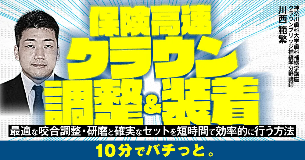 保険高速クラウン調整＆装着｜歯科オンラインセミナー・録画配信は1D