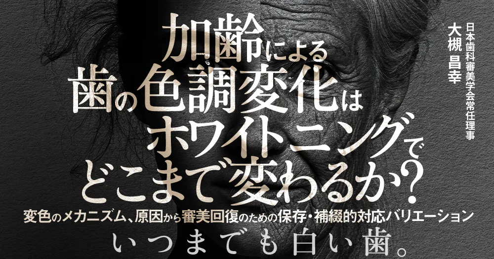 田上順次先生の「ザ・ホワイトニング」。導入のすすめとメインテナンス