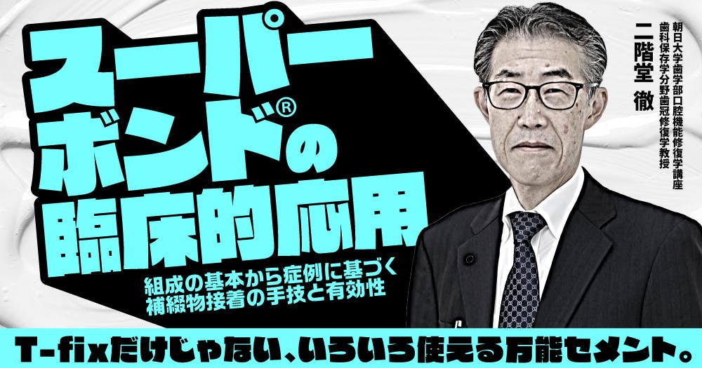 歯に優しいけどムズかしい、接着ブリッジの臨床論。デザイン・形成の
