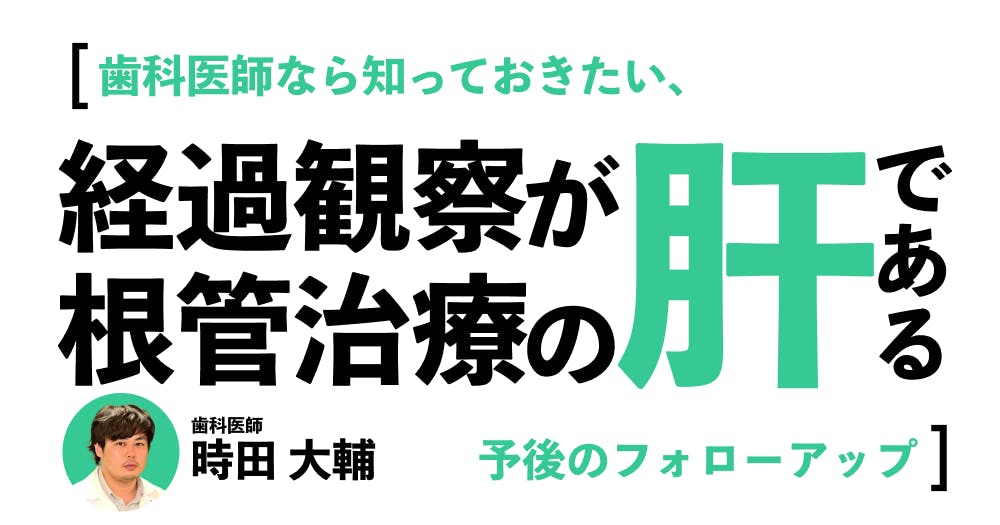 DVD クリニカル・エンドドンティックス 歯科 歯医者 根管治療 歯科医 DVD クリニカル・エンドドンティックス 歯科 歯医者 根管治療 歯科医
