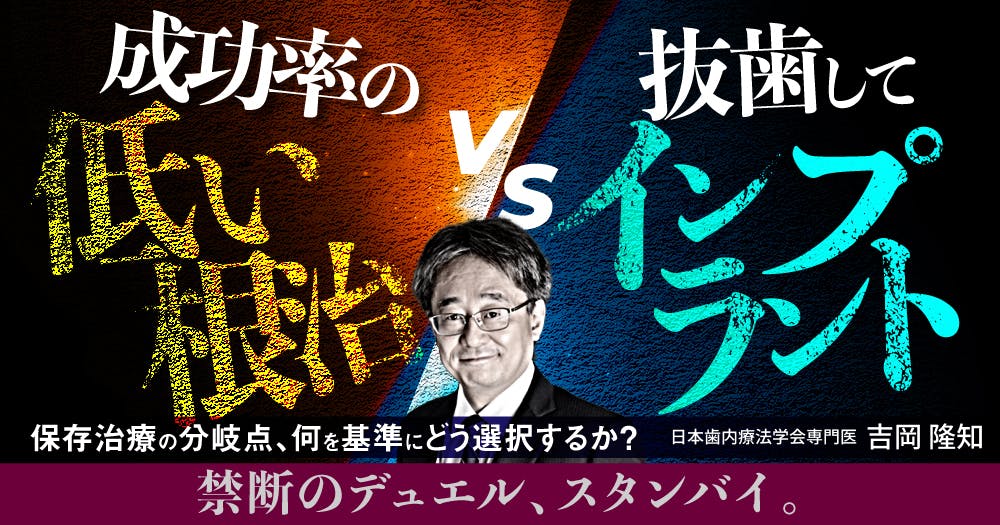 成功率の低い根治」vs「抜歯してインプラント」｜歯科オンライン