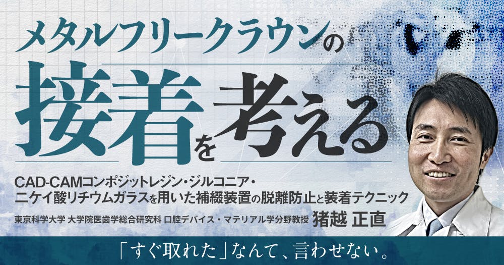 歯に優しいけどムズかしい、接着ブリッジの臨床論｜歯科