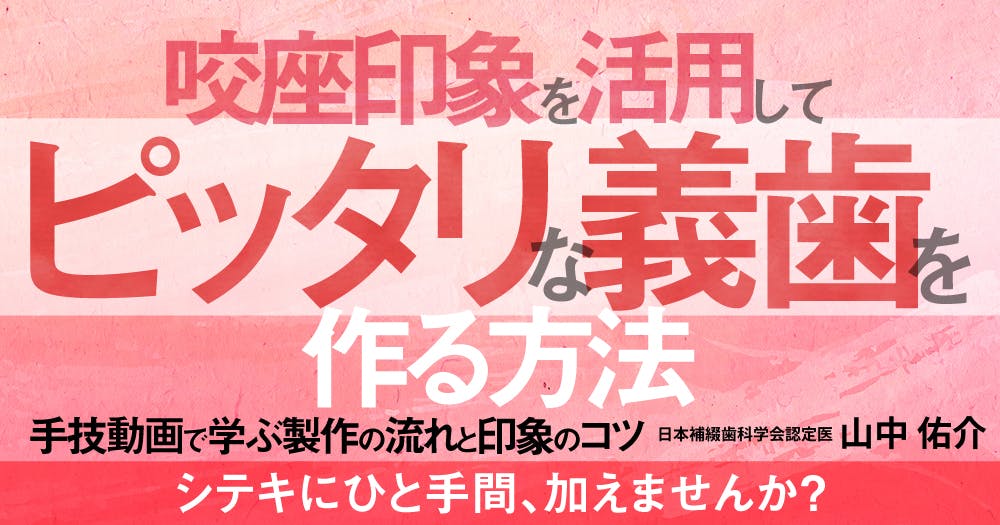 患者との信頼関係を築く総義歯製作法 ティッシュコンディショナ-を活用して　歯科医師マニ/わかば出版/ア-ル・パウンド（単行本） How to mix tissue conditioner and apply it to dentures - YouTube