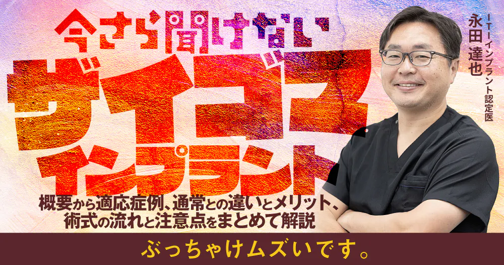 今さら聞けない「ザイゴマインプラント」｜歯科オンラインセミナー