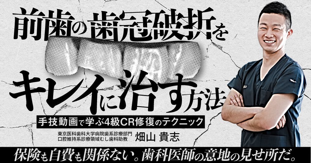 保険の審美修復を極める : CR&CAD/CAM冠・インレーに対応…（裁断済） 保険の審美修復を極める - クインテッセンス出版
