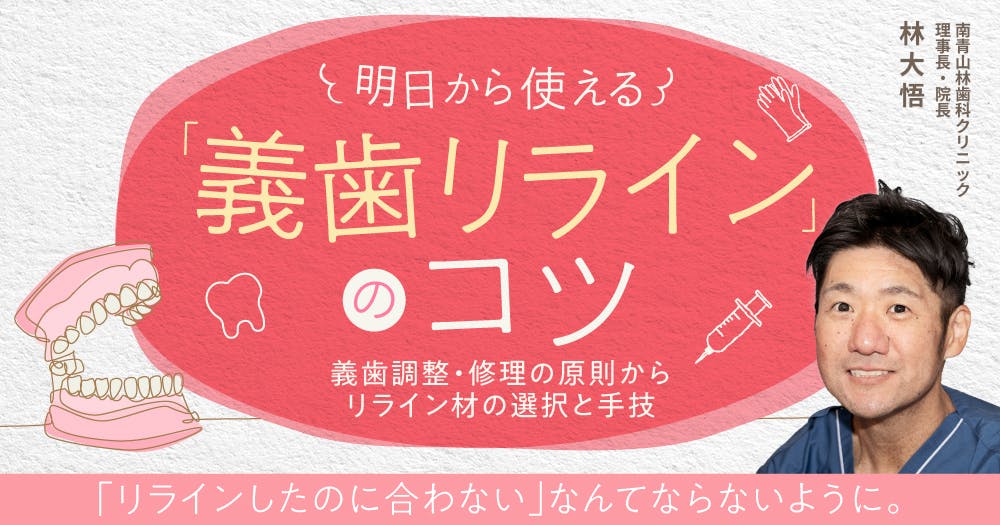 明日から使える「義歯リライン」のコツ。義歯調整・修理の原則