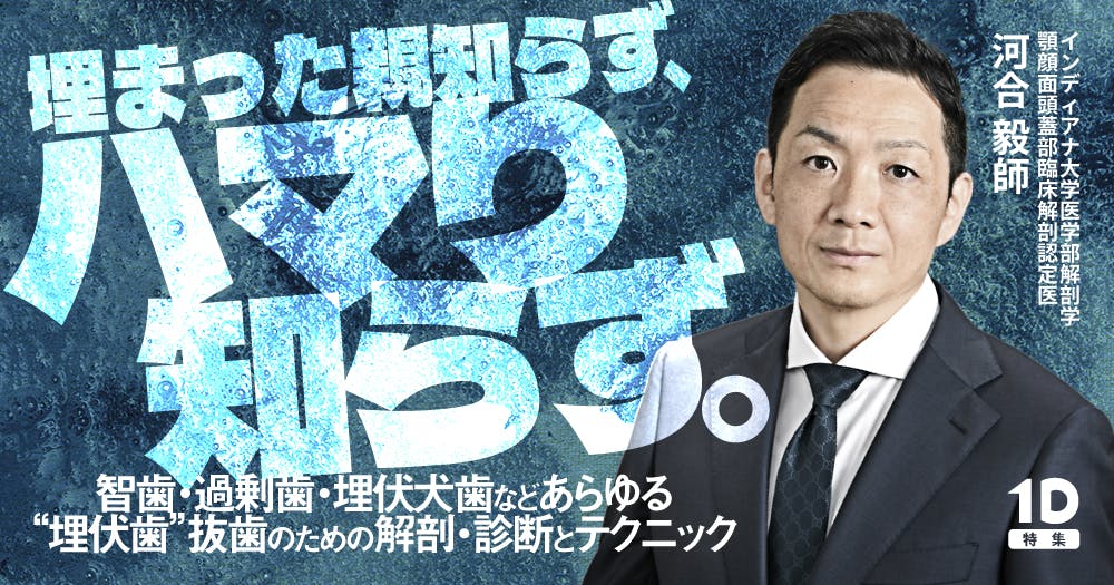 みんなもできる水平埋伏抜歯テク。麻酔、手技のポイントを解説｜歯科