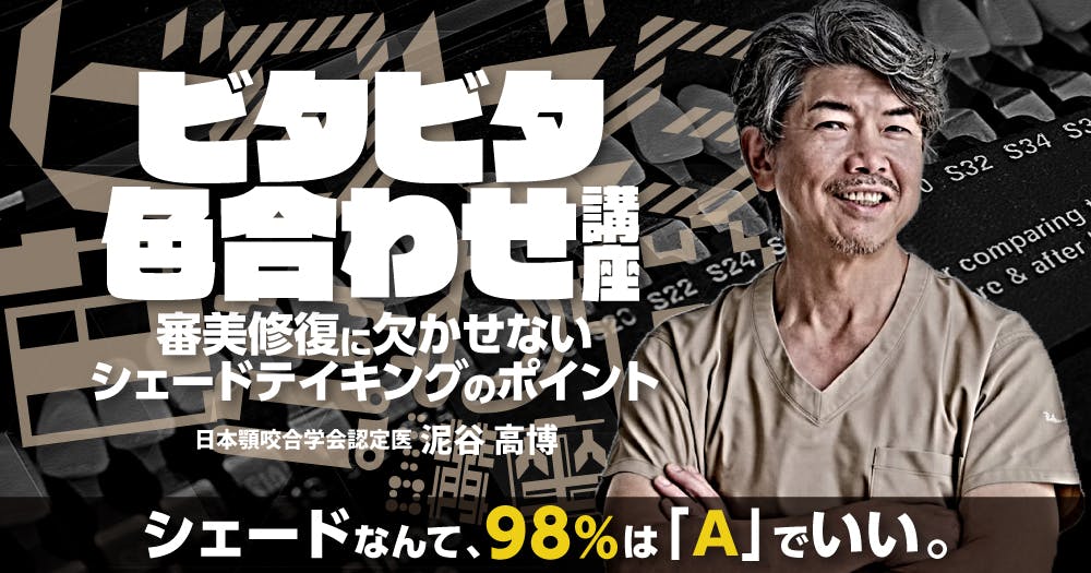 ビタビタ色合わせ講座。シェードテイキング・シェードマッチングにお