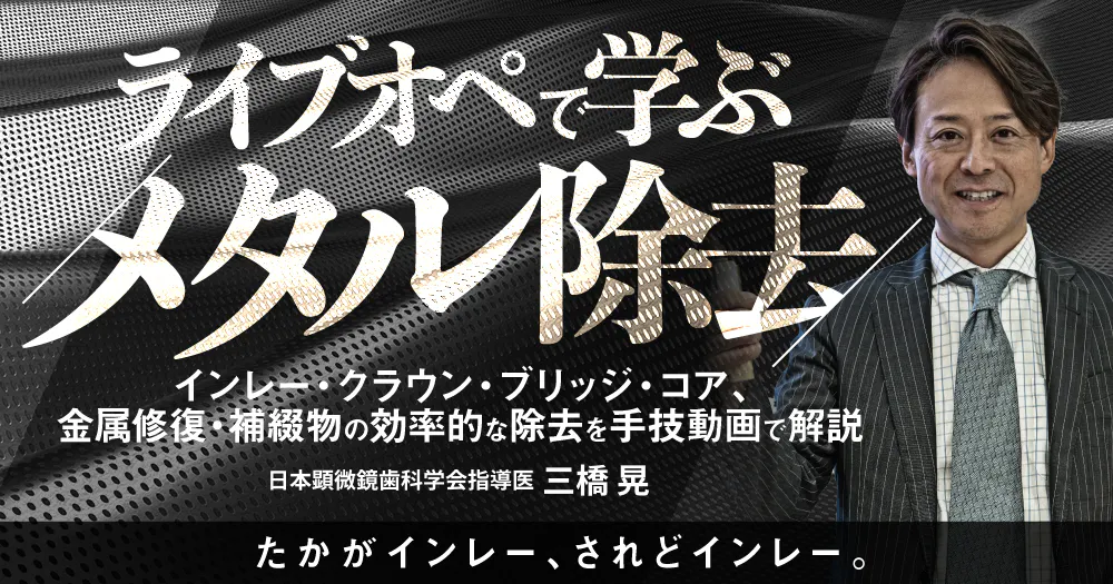 クラウンブリッジセミナー動画一覧｜歯科オンラインセミナー・録画配信