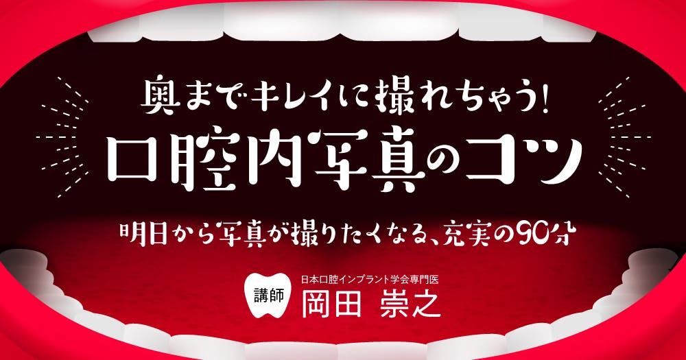 popo様　智歯の抜歯ナビゲーション popo様 智歯の抜歯ナビゲーション 智歯の抜歯ナビゲ-ション | 笠崎