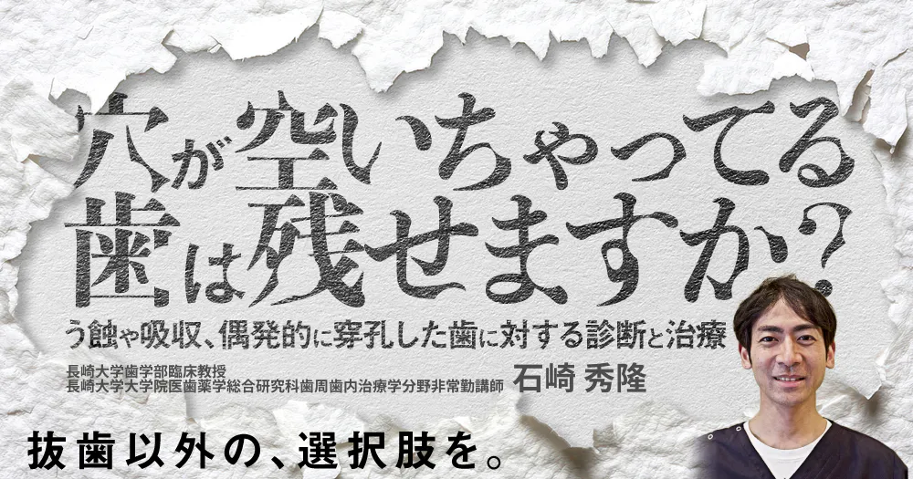 人口芝で何回かした使っていなかったので歯はほとんど削れていません。 穴が空いちゃってる歯は残せますか？｜歯科オンラインセミナー・録画