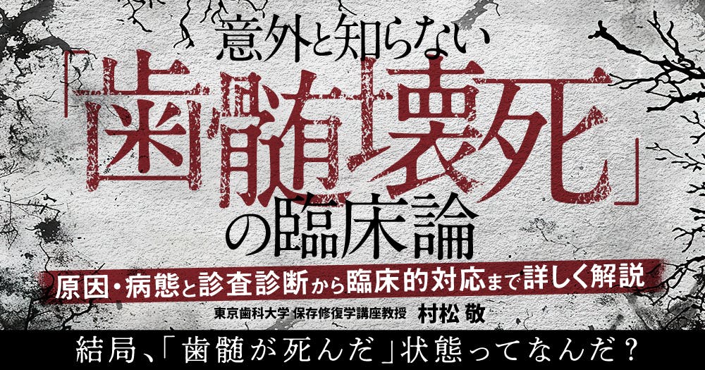 意外と知らない「歯髄壊死」の臨床論｜歯科オンラインセミナー