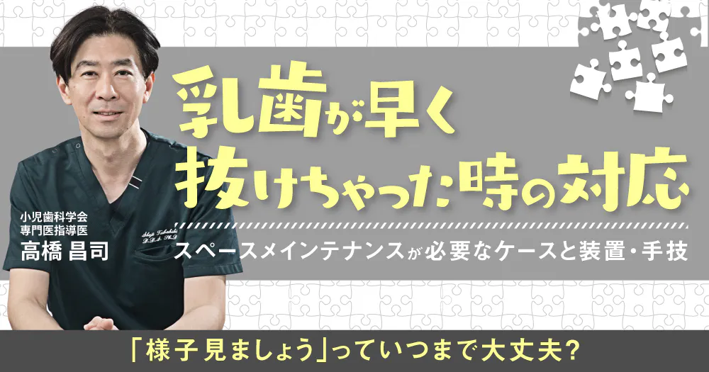小児の接着、なんかムズい。う蝕処置における防湿とGICの応用、チェア