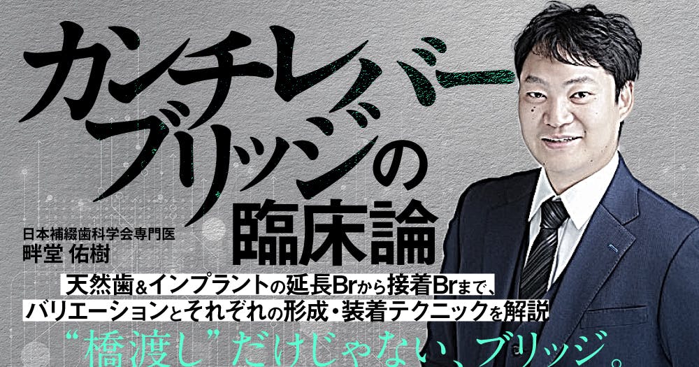 カンチレバーブリッジの臨床論｜歯科オンラインセミナー・録画配信は1D