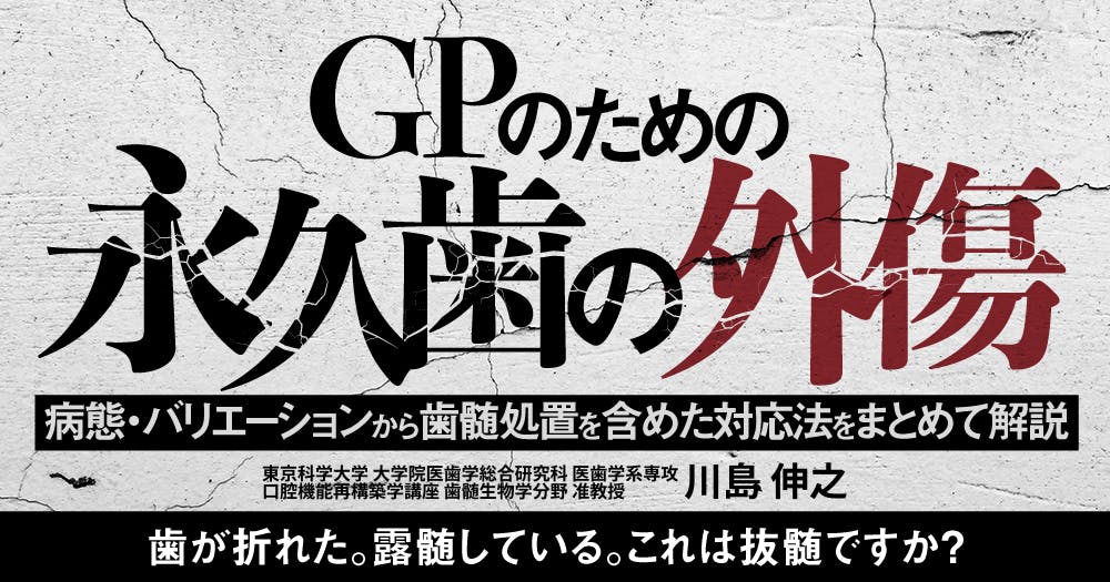 外傷歯の診断と治療 外傷歯の診断と治療 増補新版 - クインテッセンス出版